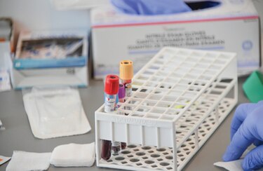 Aumentan desembolsos de seguros por reclamos vinculados a la pandemia