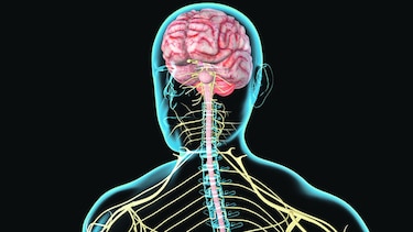 Esclerosis múltiple, su diagnóstico y tratamiento
