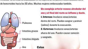 El tabú de una inflamación