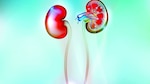 Lesión renal