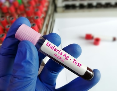 La malaria está controlada en áreas endémicas: Minsa
