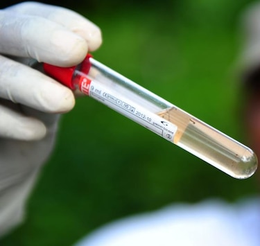 Nicaragua reporta nuevo caso de chikungunya; suman 16 los afectados por el virus