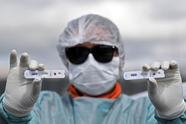 Brasil supera los 5,000 muertos por coronavirus y reconoce ‘agravamiento de la situación'