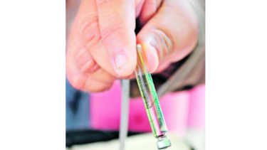 Minsa confirma seis casos de microcefalia