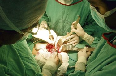 Más pacientes en hemodiálisis que en lista para trasplante