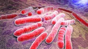 Batalla contra la sepsis
