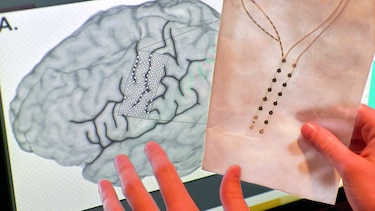 Prótesis controlada por ondas cerebrales