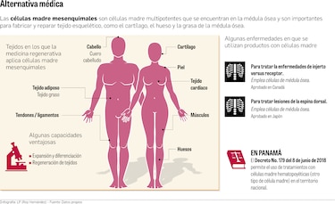 Ensayo preclínico de células madre para tratar    SARS-CoV-2            