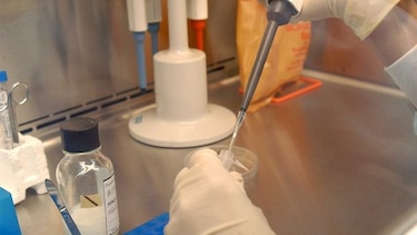 Suben a 31 los casos por virus hanta en Los Santos
