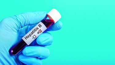 Impacto de la hepatitis