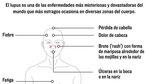 La autoagresión del lupus