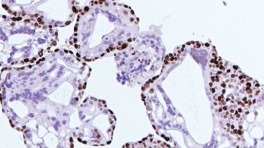 Científicos desarrollan una placenta artificial