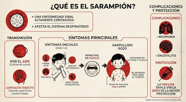 ‘El sarampión puede seguir entrando al país’, advierte exdirector del Gorgas