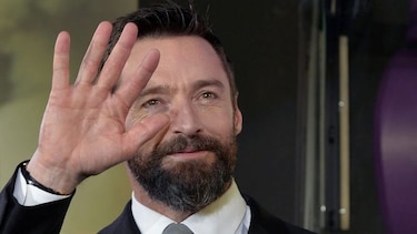 Hugh Jackman canceló actuación por hemorragia de cuerdas vocales