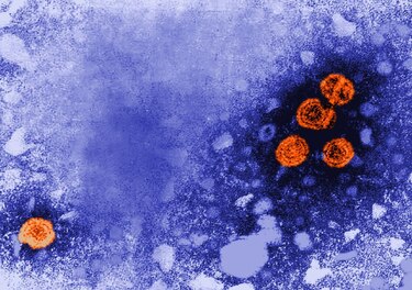 Primer caso de hepatitis aguda; sin relación con el SARS-CoV-2