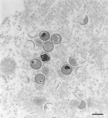 Más de 5,000 casos de viruela del mono confirmados en el mundo, anuncia la OMS