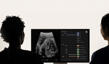 La IA aplicada en medicina: cómo puede ayudar a prevenir enfermedades y detectar cardiopatías en ecografías prenatales