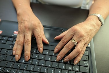 La artritis se puede controlar