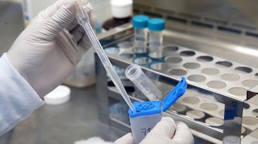 Cepa Beijing de tuberculosis en Colón: Minsa  garantiza eficacia de los tratamientos 