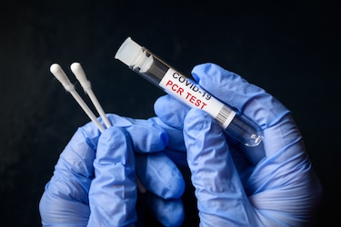 ¿Por qué el número de contagios ya no es relevante para medir cómo vamos con la covid-19?