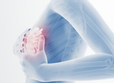 La Radio-Oncología es clave en el tratamiento del cáncer de mama