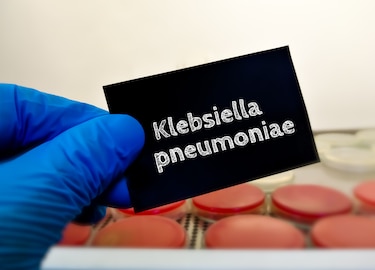 Estudio identifica siete nuevos perfiles genéticos de ‘Klebsiella’ en Panamá