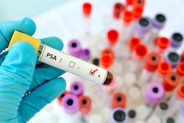 Lanzan campaña nacional sobre salud prostática prevención del cáncer de próstata