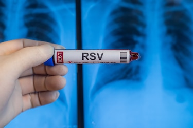 Panamá es parte del estudio de una vacuna contra el virus sincitial en embarazadas