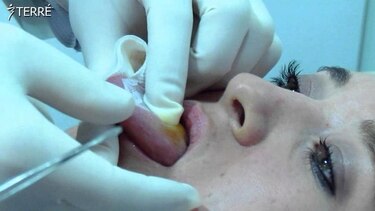 Advierten de los peligros de la malla reductora para la salud bucal