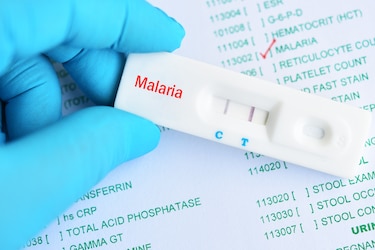 Minsa alinea estrategia ante el auge de la malaria