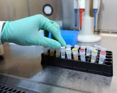 Avances prometedores en el tratamiento conjunto de la hepatitis C y el VIH