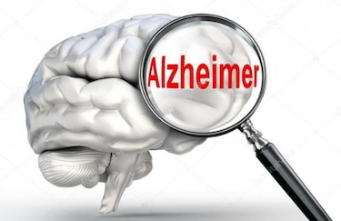 Fracaso de droga contra el Alzheimer plantea dudas a investigadores