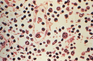 Hantavirus y covid-19 no son iguales: expertos descartan otra pandemia