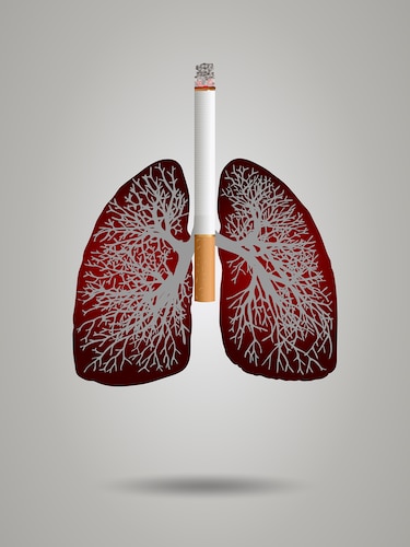 El tabaco y la exposición al humo: principales causas de la EPOC