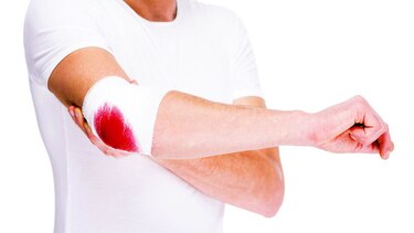 Luchar contra la hemofilia
