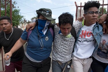 Sujetos armados chocan con manifestantes en Managua