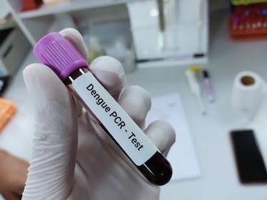 OPS prevé un aumento de casos de dengue en Panamá durante el segundo semestre del año  