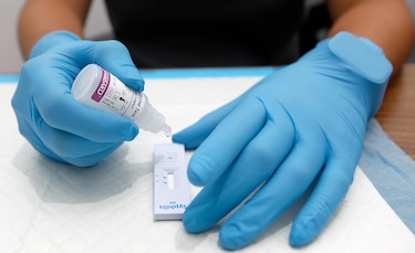 Conavih retoma sesiones tras más de un año en medio de desafíos frente al VIH