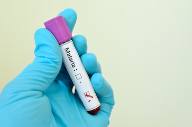 Minsa voltea la mirada hacia la malaria ante el aumento de casos en el país  