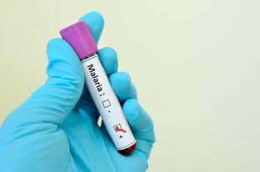Minsa voltea la mirada hacia la malaria ante el aumento de casos en el país