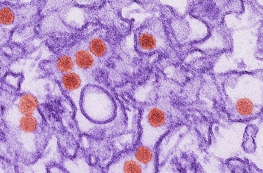Riesgo de zika por relaciones sexuales duraría un mes