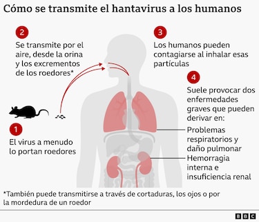 Minsa confirma la primera muerte por hantavirus de 2026 en Panamá