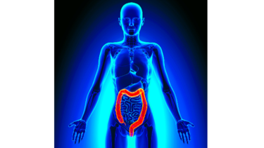 4 mitos sobre el cáncer colorrectal