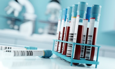 Viruela del mono: Panamá toma medidas preventivas ante alerta sanitaria
