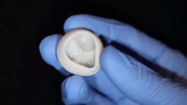 Científicos de EU anuncian avance en impresión 3D de partes del corazón
