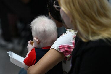 El albinismo es una condición genética poco frecuente y no contagiosa