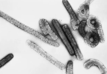 La OMS analiza con Guinea Ecuatorial posibles ensayos de tratamientos contra el virus de Marburgo