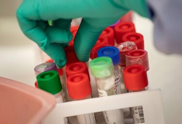 Anuncian listado de aseguradoras que darán cobertura médica por coronavirus