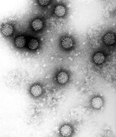 Identifican cerca de 100 mil nuevos tipos de virus previamente desconocidos para la ciencia