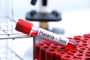 Costa Rica celebra reducción del 94.5% en los casos de malaria durante 2025
